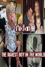Watch Aidan The Rarest Boy In The World Myflixer