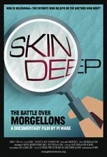 Watch Skin Deep: The Battle Over Morgellons Myflixer