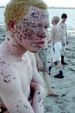Watch Albino United Myflixer