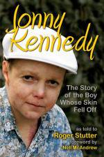 Watch The Boy Whose Skin Fell Off Myflixer