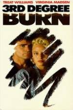 Watch Third Degree Burn Myflixer