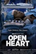 Watch Open Heart Myflixer