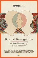 Watch Beyond Recognition: The Incredible Story of a Face Transplant Myflixer