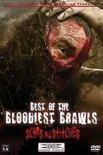 Watch TNA Wrestling: Best of the Bloodiest Brawls - Scars and Stitches Myflixer