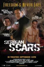 Watch Serbian Scars Myflixer