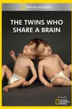 Watch National Geographic The Twins Who Share A Brain Myflixer