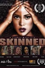 Watch Skinned Myflixer