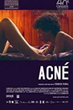 Watch Acné Myflixer