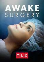 Watch Awake Surgery Myflixer