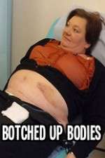 Watch Botched Up Bodies Myflixer